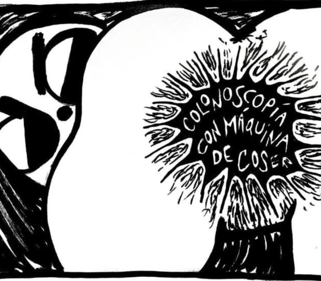 Colonoscopia con Máquina de Cocer